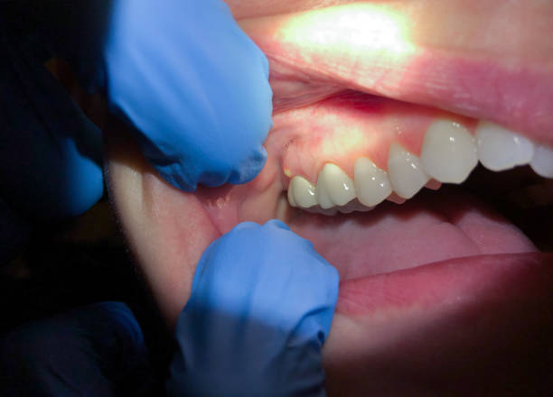 Best Emergency Treatment for Toothache in Chatsworth, IL