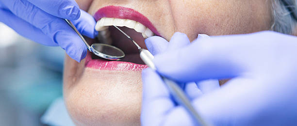 Best Emergency Tooth Extraction in Chatsworth, IL